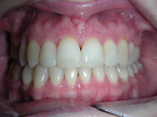 Orthodontic case study 1 - after image