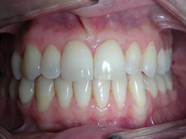Orthodontic case study image