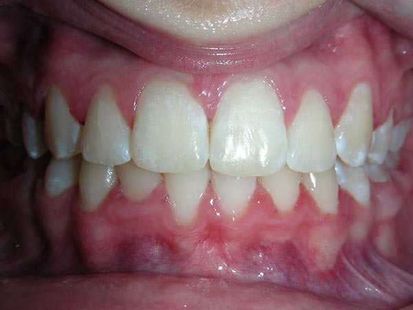 Orthodontic education: case study pic 2