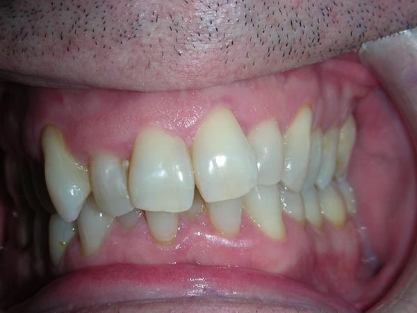 Orthodontic case study 2 - before image