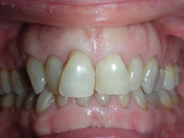 Orthodontic case study 7 - before image