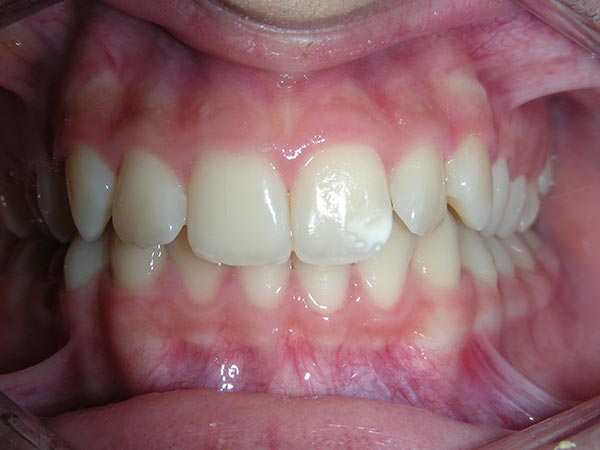 Orthodontic case study image 3